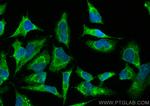 Rac1 Antibody in Immunocytochemistry (ICC/IF)