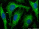 IL-28B/IFNL3 Antibody in Immunocytochemistry (ICC/IF)