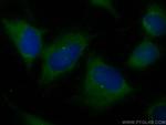 CEP135 Antibody in Immunocytochemistry (ICC/IF)
