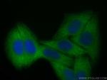 GEF-H1 Antibody in Immunocytochemistry (ICC/IF)