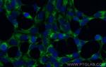 AMOT Antibody in Immunocytochemistry (ICC/IF)