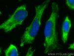 ZW10 Antibody in Immunocytochemistry (ICC/IF)