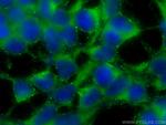 Tuberin/TSC2 Antibody in Immunocytochemistry (ICC/IF)