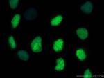 TOP2A Antibody in Immunocytochemistry (ICC/IF)