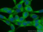 CCT2 Antibody in Immunocytochemistry (ICC/IF)