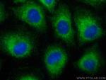 GRAMD1B Antibody in Immunocytochemistry (ICC/IF)