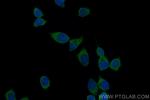 HDAC10 Antibody in Immunocytochemistry (ICC/IF)