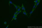 ADAMTS12 Antibody in Immunocytochemistry (ICC/IF)
