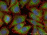 C6orf15 Antibody in Immunocytochemistry (ICC/IF)