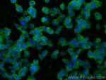 HuD Antibody in Immunocytochemistry (ICC/IF)