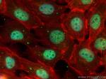 MORC3 Antibody in Immunocytochemistry (ICC/IF)