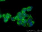 RNF135 Antibody in Immunocytochemistry (ICC/IF)