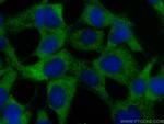 SAMD9L Antibody in Immunocytochemistry (ICC/IF)