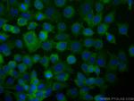 Desmoplakin Antibody in Immunocytochemistry (ICC/IF)
