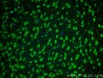 SLC25A22 Antibody in Immunohistochemistry (PFA fixed) (IHC (PFA))