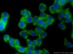 YTHDF3 Antibody in Immunocytochemistry (ICC/IF)