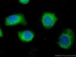 TEX264 Antibody in Immunocytochemistry (ICC/IF)