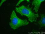CLTC Antibody in Immunocytochemistry (ICC/IF)