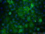 CD55 Antibody in Immunocytochemistry (ICC/IF)