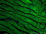 Cardiac Troponin T Antibody in Immunohistochemistry (PFA fixed) (IHC (PFA))