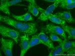 Bcl2 Antibody in Immunocytochemistry (ICC/IF)