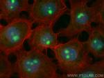 P27/KIP1 Antibody in Immunocytochemistry (ICC/IF)