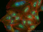 P27/KIP1 Antibody in Immunocytochemistry (ICC/IF)