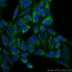 TUFM Antibody in Immunocytochemistry (ICC/IF)