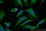 SUFU Antibody in Immunocytochemistry (ICC/IF)