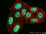 CstF-64 Antibody in Immunocytochemistry (ICC/IF)