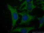 PKC Zeta Antibody in Immunocytochemistry (ICC/IF)