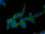 PKC Zeta Antibody in Immunocytochemistry (ICC/IF)