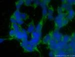 Fibrillin 1 Antibody in Immunocytochemistry (ICC/IF)