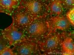 Integrin Alpha V Antibody in Immunocytochemistry (ICC/IF)