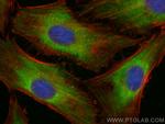 DOCK4 Antibody in Immunocytochemistry (ICC/IF)