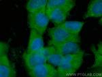 WNT2 Antibody in Immunocytochemistry (ICC/IF)