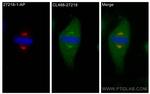 KIF2A Antibody in Immunocytochemistry (ICC/IF)