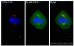 KIF2A Antibody in Immunocytochemistry (ICC/IF)