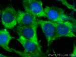 NPPA Antibody in Immunocytochemistry (ICC/IF)