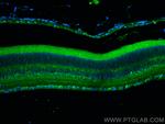 CACNA2D1 Antibody in Immunohistochemistry (PFA fixed) (IHC (PFA))