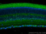 CACNA2D1 Antibody in Immunohistochemistry (PFA fixed) (IHC (PFA))