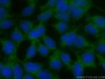 ELA2 Antibody in Immunocytochemistry (ICC/IF)
