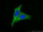 MUC2 Antibody in Immunocytochemistry (ICC/IF)
