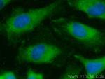 RanBP1 Antibody in Immunocytochemistry (ICC/IF)