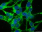 Titin Antibody in Immunocytochemistry (ICC/IF)