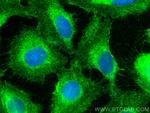 NKCC1, SLC12A2 Antibody in Immunocytochemistry (ICC/IF)