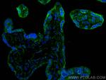 PD-L1/CD274 Antibody in Immunohistochemistry (PFA fixed) (IHC (PFA))