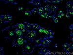 Band 3/AE 1 Antibody in Immunohistochemistry (PFA fixed) (IHC (PFA))