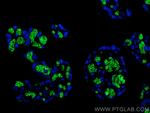 Band 3/AE 1 Antibody in Immunohistochemistry (PFA fixed) (IHC (PFA))