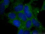 Collagen Type II Antibody in Immunocytochemistry (ICC/IF)